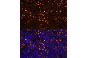 Immunofluorescence analysis of mouse spleen using CLEC4D Rabbit pAb (ABIN3016482, ABIN3016483, ABIN3016484 and ABIN6219759) at dilution of 1:100 (40x lens). (CLEC4D antibody  (AA 39-215))