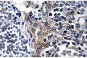Immunohistochemistry (IHC) analyzes of VASP antibody in paraffin-embedded human tonsil tissue. (VASP antibody  (pSer157))
