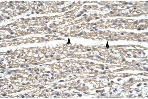 Human Heart; ZNF336 antibody - N-terminal region in Human Heart cells using Immunohistochemistry