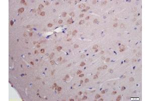 Formalin-fixed and paraffin embedded rat brain labeled with Rabbit Anti-RNA polymerase II CTD repeat YSPTSPS (Ser2) Polyclonal Antibody, Unconjugated (ABIN718391) at 1:200 followed by conjugation to the secondary antibody and DAB staining (RNA Polymerase 2 (pSer2) antibody)