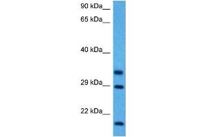 Host:  Mouse  Target Name:  FHL1  Sample Tissue:  Mouse Skeletal Muscle  Antibody Dilution:  1ug/ml (FHL1 antibody  (C-Term))