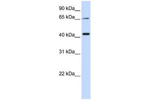 WB Suggested Anti-QPCTL Antibody Titration:  0.