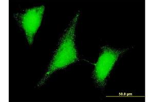 Immunofluorescence of monoclonal antibody to UBE2W on HeLa cell. (UBE2W antibody  (AA 17-112))