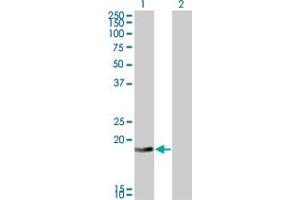 Image no. 1 for anti-DCMP Deaminase (DCTD) (AA 69-179) antibody (ABIN466000) (DCMP Deaminase (DCTD) (AA 69-179) antibody)