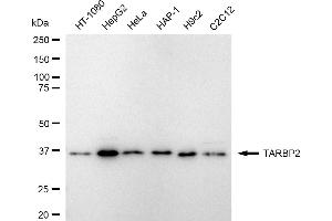 Western blotting analysis using TARBP2 antibody (ABIN7800510).
