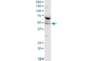 FARSLA polyclonal antibody (A01), Lot # 060102JC01. (Phenylalanyl-tRNA Synthetase, alpha Subunit (FARSA) (AA 101-201) antibody)