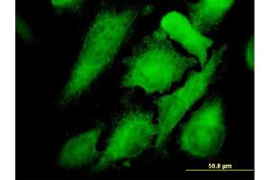 Immunofluorescence of monoclonal antibody to MAPK12 on HeLa cell. (MAPK12 antibody  (AA 251-367))