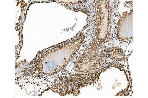 IHC analysis of AS160/TBC1D4 using anti-AS160/TBC1D4 antibody (ABIN7599745). (TBC1D4 antibody  (AA 1118-1298))