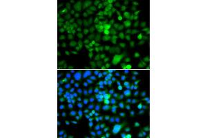 Immunofluorescence analysis of A549 cells using NAP1L3 antibody (ABIN5974335).