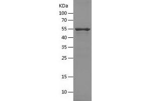 Western Blotting (WB) image for Legumain (LGMN) (AA 18-325) protein (His-IF2DI Tag) (ABIN7123739) (LGMN Protein (AA 18-325) (His-IF2DI Tag))