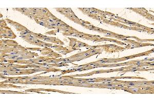 Immunohistochemistry (IHC) image for anti-Receptor (TNFRSF)-Interacting serine-threonine Kinase 1 (RIPK1) (AA 17-289) antibody (ABIN7441202)