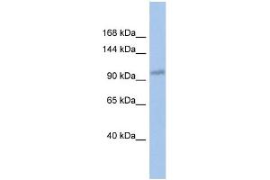 WB Suggested Anti-DDX24 Antibody Titration:  0. (DDX24 antibody  (Middle Region))