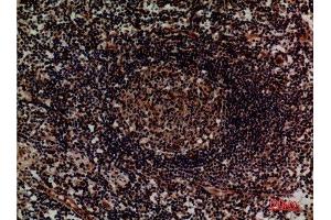 Immunohistochemistry (IHC) analysis of paraffin-embedded Human Lymph, antibody was diluted at 1:100. (ITGA4 antibody  (Internal Region))