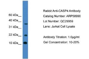 WB Suggested Anti-CASP4  Antibody Titration: 0. (Caspase 4 antibody  (Middle Region))