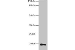 Western blot All lanes: RAB30 antibody at 1 μg/mL + Hela whole cell lysate Secondary Goat polyclonal to rabbit IgG at 1/10000 dilution Predicted band size: 24, 19 kDa Observed band size: 19 kDa (RAB3A antibody  (AA 1-200))