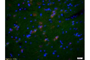 Formalin-fixed and paraffin-embedded rat brain labeled with Anti-GluR1/AMPA Polyclonal Antibody, Unconjugated (ABIN1385842) 1:200, overnight at 4°C, The secondary antibody was Goat Anti-Rabbit IgG, Cy3 conjugated used at 1:200 dilution for 40 minutes at 37°C. (GluR1, GluR2 antibody  (AA 141-240))