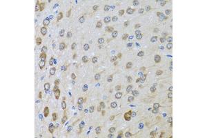 Immunohistochemistry of paraffin-embedded rat brain using BTD antibody (ABIN6127510, ABIN6137680, ABIN6137682 and ABIN6221882) at dilution of 1:100 (40x lens). (BTD antibody  (AA 284-543))
