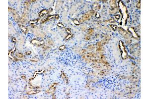 Immunohistochemistry (IHC) image for anti-Aldehyde Dehydrogenase 1 Family, Member A3 (ALDH1A3) (AA 37-154) antibody (ABIN5518802)