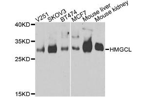 Western blot analysis of extracts of various cell lines, using HMGCL antibody. (HMGCL antibody)