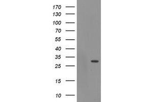 Western Blotting (WB) image for anti-Exosome Component 3 (EXOSC3) antibody (ABIN1498139)