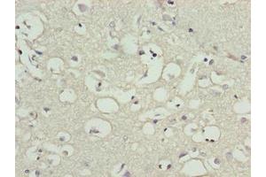 Immunohistochemistry of paraffin-embedded human brain tissue using ABIN7165213 at dilution of 1:100 (CNIH3 antibody  (AA 94-138))