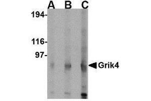 Western blot analysis of Grik4 in rat brain lysate with Grik4 antibody at (A) 0.