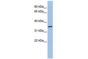Image no. 1 for anti-PHD Finger Protein 13 (PHF13) (AA 36-85) antibody (ABIN6741099) (PHF13 antibody  (AA 36-85))