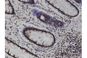 Immunoperoxidase of monoclonal antibody to MLKL on formalin-fixed paraffin-embedded human colon. (MLKL antibody  (AA 371-471))