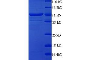 VP2 (AA 2-344) protein (His-SUMO Tag)