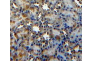 Used in DAB staining on fromalin fixed paraffin-embedded kidney tissue (SOCS3 antibody  (AA 1-225))