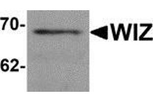 Western blot analysis of WIZ in rat lung tissue lysate with WIZ antibody at 1 μg/ml.