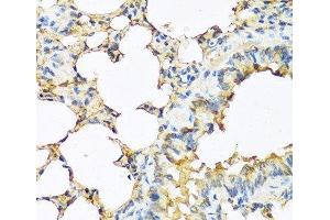 Immunohistochemistry of paraffin-embedded Mouse lung using TSHB Polyclonal Antibody at dilution of 1:100 (40x lens). (TSHB antibody)