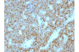 Formalin-fixed, paraffin-embedded human Parathyroid Gland stained with PTH Mouse Monoclonal Antibody (PTH/1175). (PTH antibody  (AA 32-115))