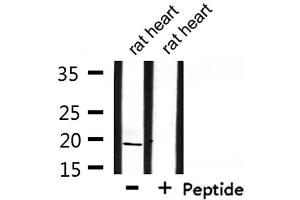 Western blot analysis of extracts from rat heart, using INSL4 Antibody.