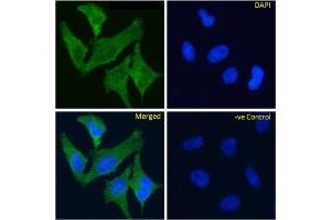 Immunofluoresence staining of fixed HeLa cells with anti-TrkA antibody MNAC13. (Recombinant TRKA antibody)