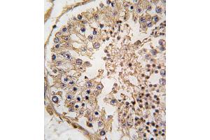 Immunohistochemistry (IHC) image for anti-B-Cell CLL/lymphoma 2 (BCL2) (BH3 Domain) antibody (ABIN2997097) (Bcl-2 antibody  (BH3 Domain))
