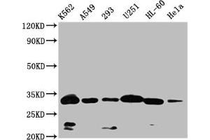 Western Blot Positive WB detected in: K562 whole cell lysate,A549 whole cell lysate,293 whole cell lysate,U251 whole cell lysate,HL-60 whole cell lysate,Hela whole cell lysate All lanes: VDAC3 antibody at 1:1000 Secondary Goat polyclonal to rabbit IgG at 1/50000 dilution Predicted band size: 31 kDa Observed band size: 32 kDa (VDAC3 antibody  (AA 40-160))
