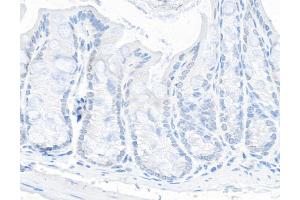 Immunohistochemistry (IHC) image for anti-Tripartite Motif Containing 24 (TRIM24) (AA 700-750) antibody (ABIN7454678) (TRIM24 antibody  (AA 700-750))