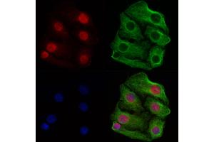 ABIN6260261 and ABIN6269348 staining Hela cells by IF/ICC. (BIK antibody  (N-Term))