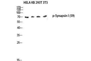 Western Blot (WB) analysis of HeLa KB 293T 3T3 lysis using Phospho-Synapsin I (S9) antibody. (SYN1 antibody  (pSer9))