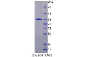 Image no. 1 for Ribosomal Protein S6 Kinase, 70kDa, Polypeptide 1 (RPS6KB1) (AA 91-352) protein (His tag) (ABIN6236474) (RPS6KB1 Protein (AA 91-352) (His tag))