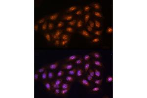 Immunofluorescence analysis of U2OS cells using [KO Validated] PPP1CC Rabbit pAb (ABIN1682257, ABIN3018437, ABIN3018438 and ABIN5664595) at dilution of 1:100 (40x lens). (PPP1CC antibody  (AA 1-323))