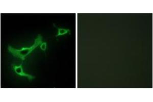 Immunofluorescence analysis of NIH-3T3 cells, using TRIM3 Antibody. (TRIM3 antibody  (AA 1-50))