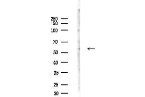 Western blot analysis of lysates from HepG2 cells(heat-shock,45 min treatment), using PAK1 Antibody at 1/1000 dilution.