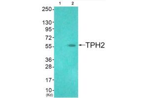 Western blot analysis of extracts from HuvEc cells (Lane 2), using TPH2 (epitope around residue 19) Antibody. (Tryptophan Hydroxylase 2 antibody  (Ser19))