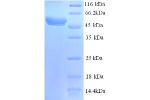 SDS-PAGE (SDS) image for Galactosamine (N-Acetyl)-6-Sulfate Sulfatase (GALNS) (AA 27-522) protein (His tag) (ABIN5713462)