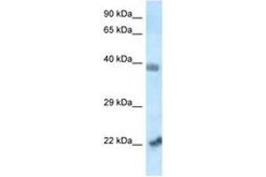 Image no. 1 for anti-Vacuolar Protein Sorting 72 Homolog (S. Cerevisiae) (VPS72) (N-Term) antibody (ABIN6747513) (VPS72 antibody  (N-Term))