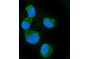 IF analysis of Epac1/RAPGEF3 using anti-Epac1/RAPGEF3 antibody (ABIN7601858). (RAPGEF3 antibody  (AA 49-881))