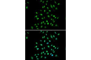 Immunofluorescence analysis of A549 cells using CXXC1 antibody. (CXXC1 antibody)