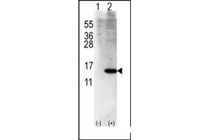 Image no. 1 for anti-ISG15 Ubiquitin-Like Modifier (ISG15) (Middle Region) antibody (ABIN356681) (ISG15 antibody  (Middle Region))